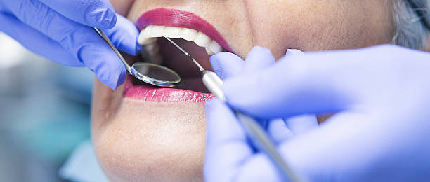 Teeth Whitening in NM